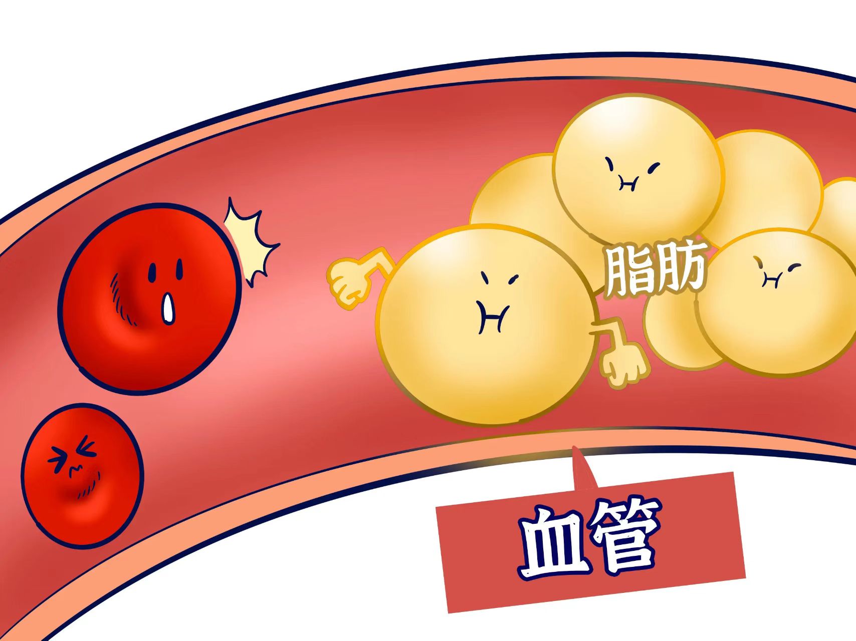 高血脂是什么原因引起的？金康道夫可(kě)以改善高血脂吗？