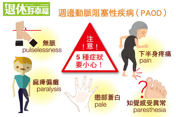 血管堵塞的临床症状！你占了几个？