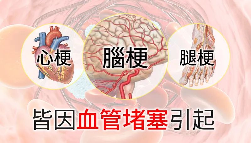 金康道夫水蛭素：血管清道夫，「梗」之克星！